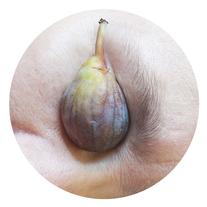 fig eye